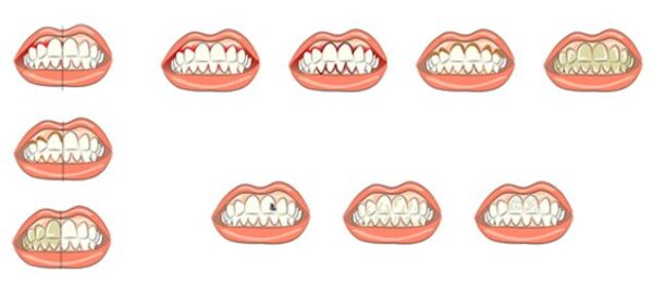 Cu Les Son Los Problemas Dentales M S Habituales Guadentis